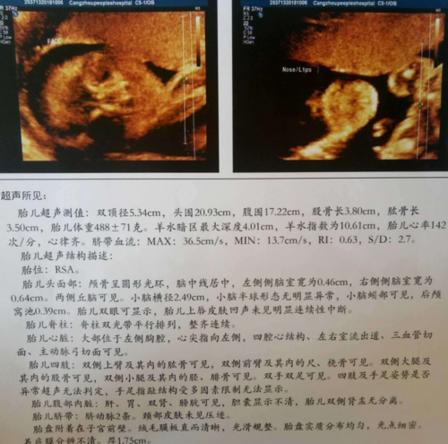 代生宝宝包儿子,武汉助孕试管婴儿胚胎移植手术的哪些常识？_上海供卵试管公